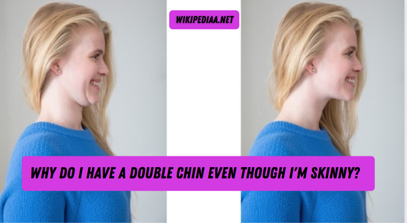Why Do I Have a Double Chin Even Though I'm Skinny?