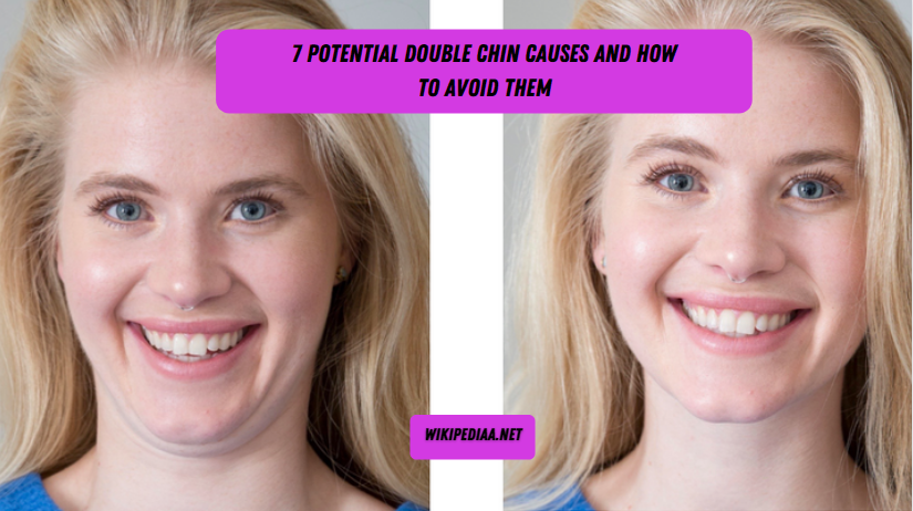 7 Potential Double Chin Causes and How to Avoid Them